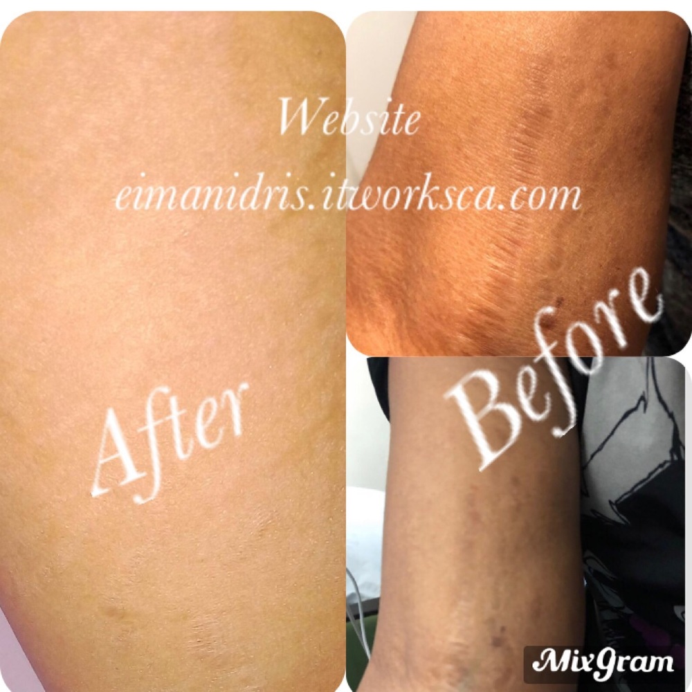 Defining gel
